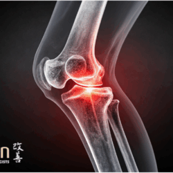 Joint Effort: How Weight Loss Helps Your Joints Work Better